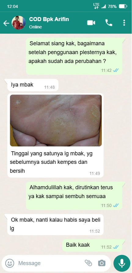 -