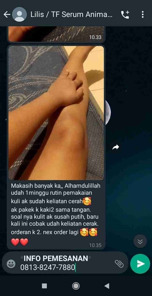 -