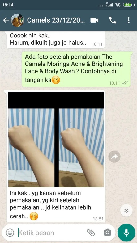 -