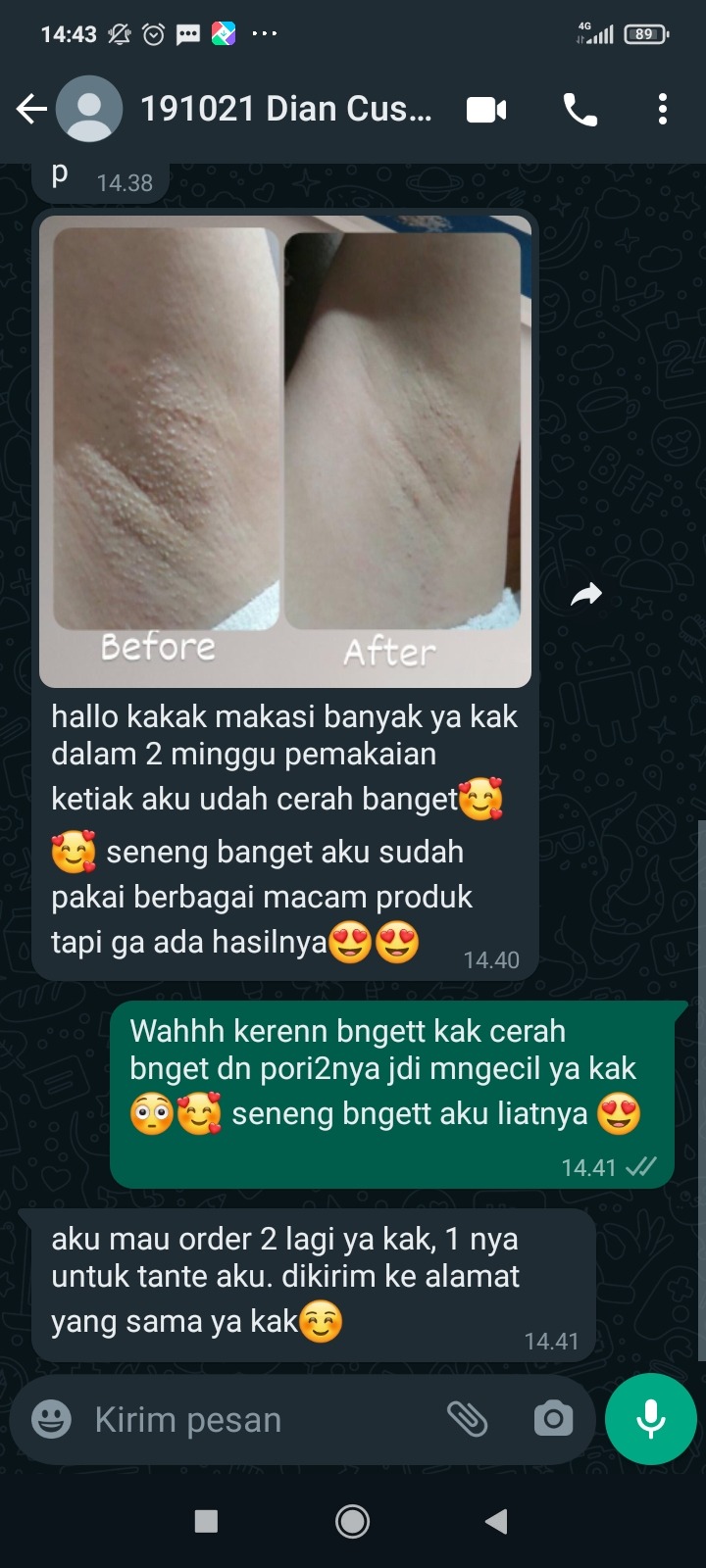 -