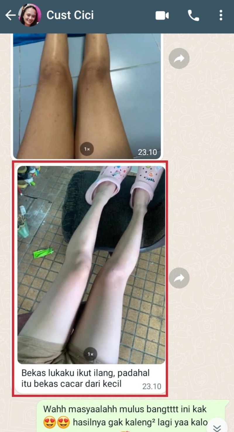 -