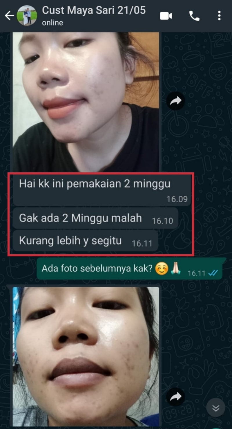 -